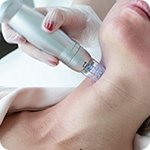 Игольчатый РФ-лифтинг