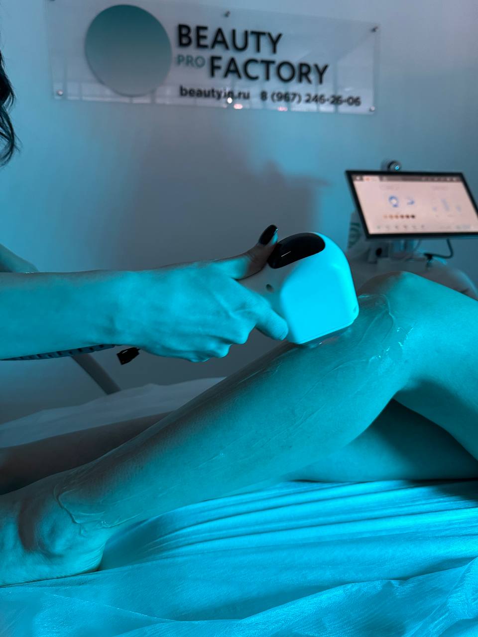 Лазерная эпиляция